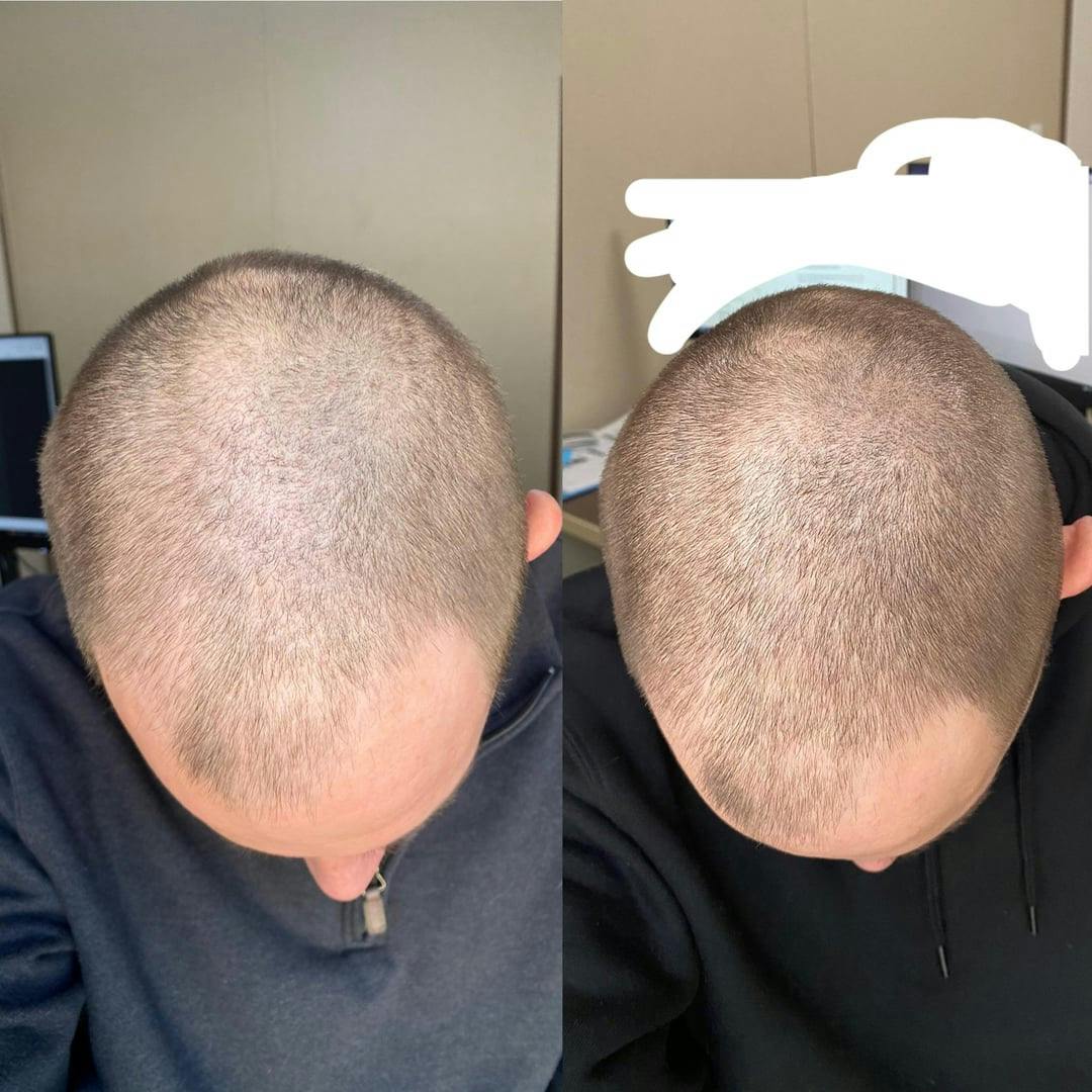 Customer transformation 3